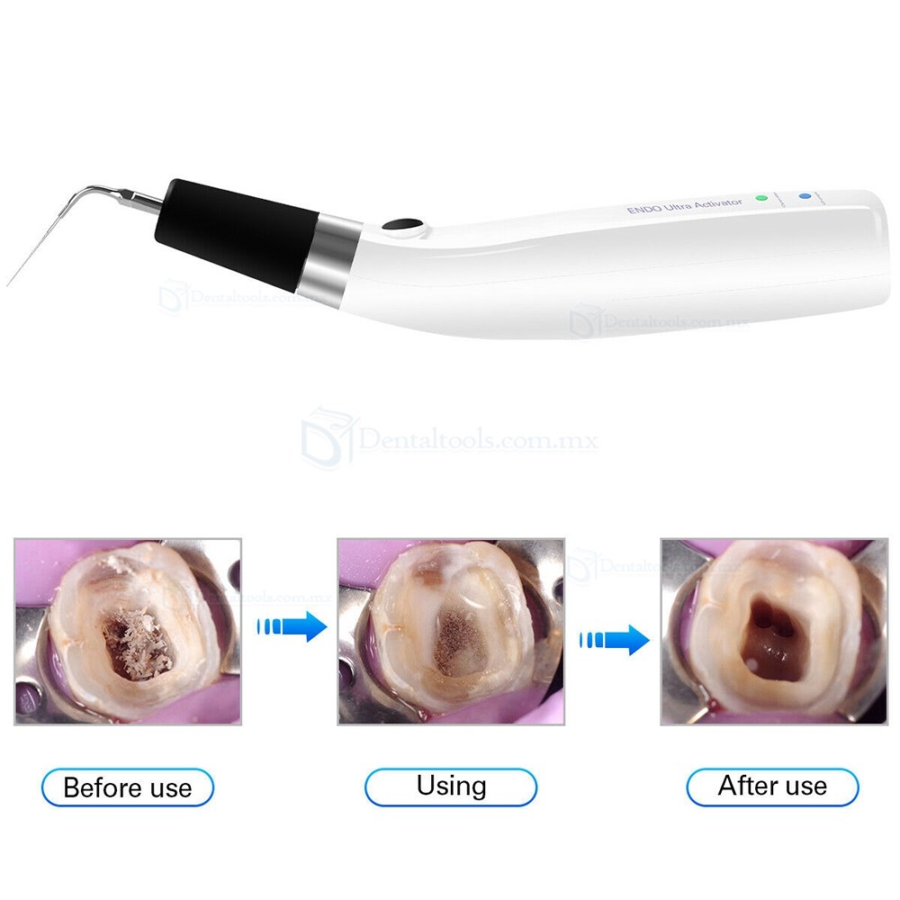 Sonic Sistema Endoactivator Para Endodoncia Irrigador de Canal Radicular con 6 Pcs Titanio Puntas